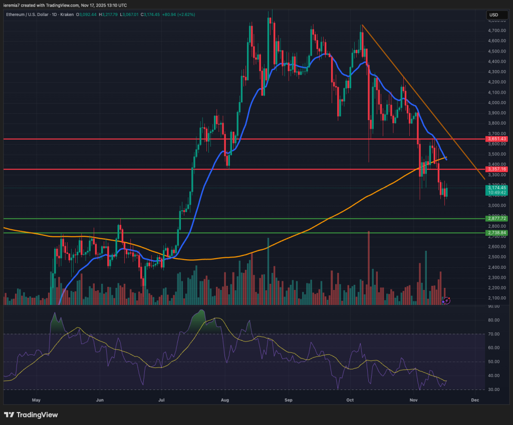 ETHUSD technical analysis