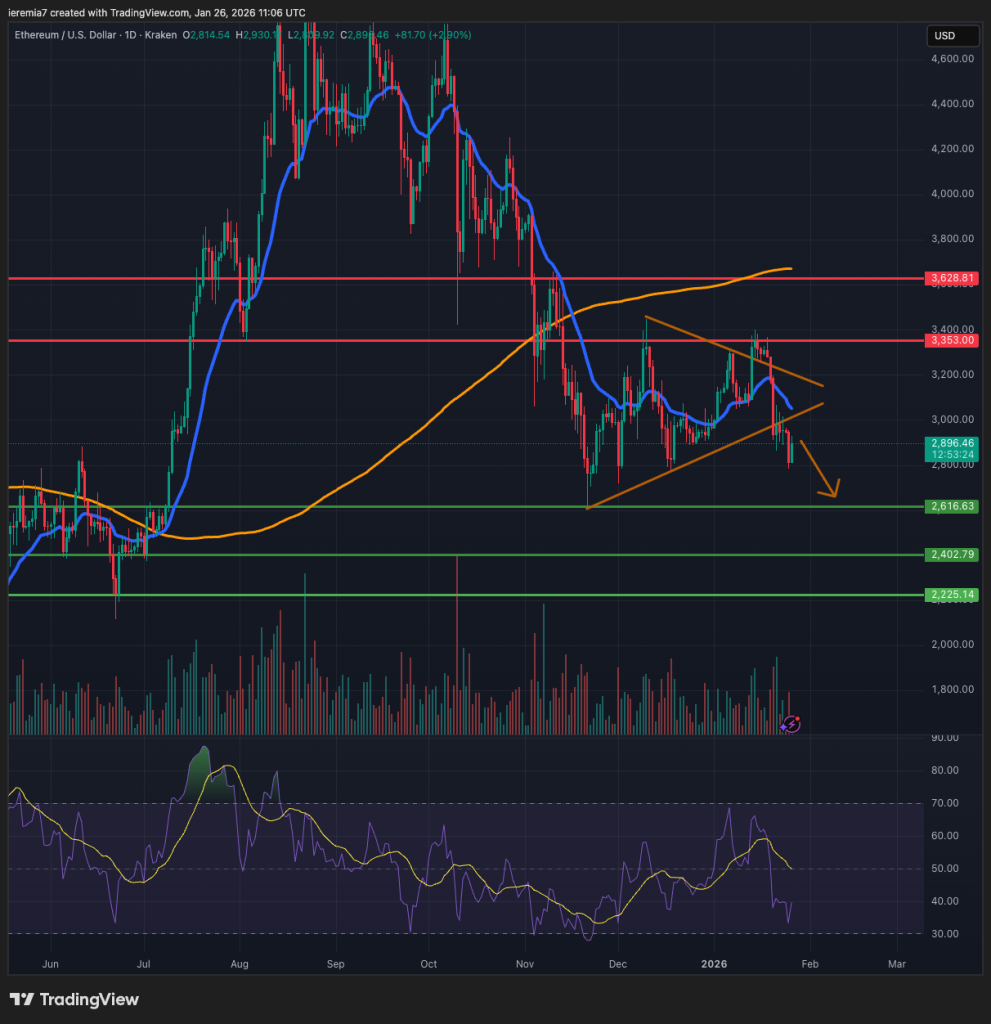 ETHUSD technical analysis
